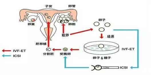 石家庄捐卵费用